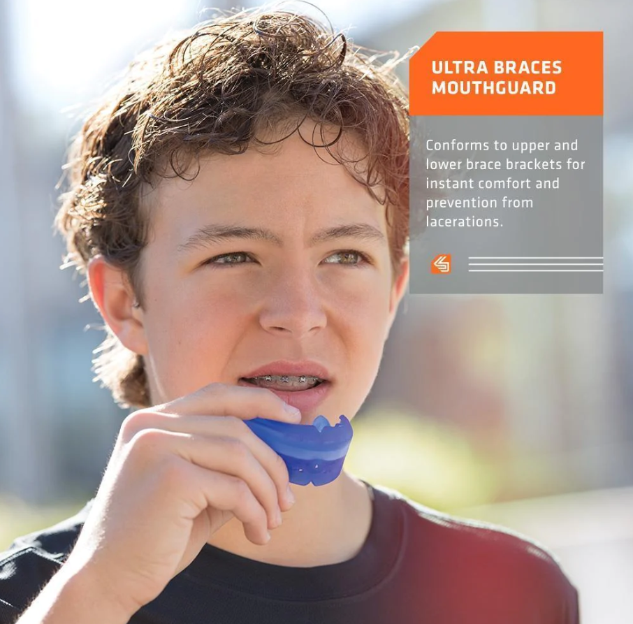 SD Ultra Braces Mouthguard (appareils orthodontiques)